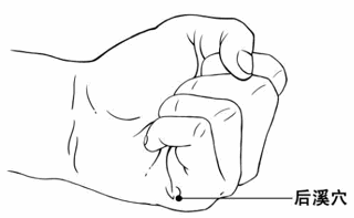 后溪穴 -- 統治一切頸肩腰椎病的神奇大穴